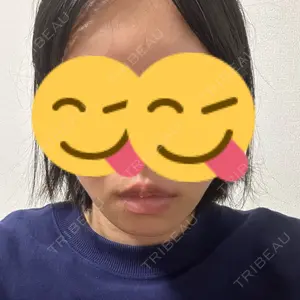 口コミ