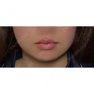 口コミ
