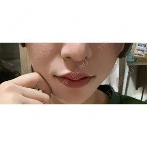 口コミ