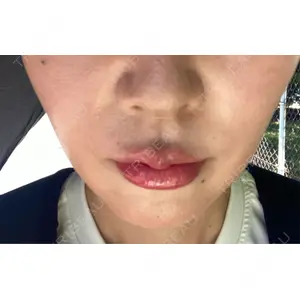 TCB東京中央美容外科 TCB東京中央美容外科 福岡博多院口コミ