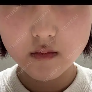 ルラ美容クリニック ルラ美容クリニック 福岡本院口コミ