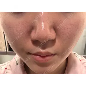 東京シルククリニック 東京シルククリニック 東京神田院口コミ