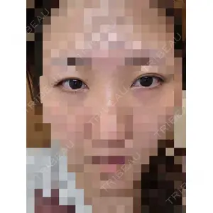 TCB東京中央美容外科 TCB東京中央美容外科 高崎院口コミ