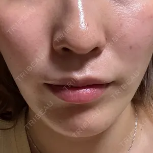 アリエル美容クリニック アリエル美容クリニック 大宮院口コミ