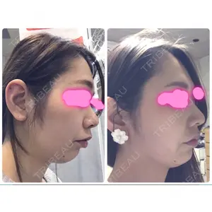HANABI整形外科口コミ
