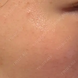 ルラ美容クリニック ルラ美容クリニック 大宮院 / ルラスキンクリニック 大宮院口コミ