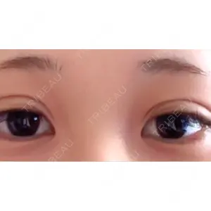 口コミ