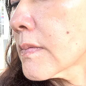 東京シルククリニック 東京シルククリニック 東京神田院口コミ