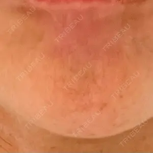 あいちビューティークリニック あいちビューティークリニック栄本院口コミ