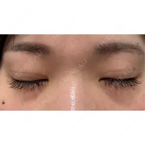 プロミス整形外科口コミ