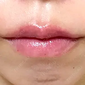 口コミ