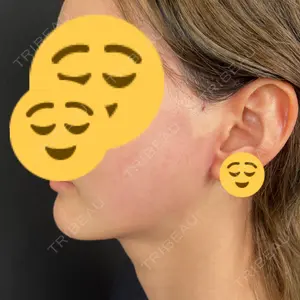 東京シンデレラ美容外科 東京シンデレラ美容外科 池袋院口コミ