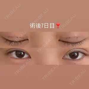 口コミ