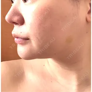 L‘amour clinic Tokyo【ラムールクリニック東京】口コミ