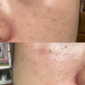 NEO Skin Clinic NEO Skin Clinic恵比寿口コミ