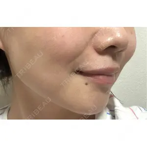 Bellefeel Clinic Bellefeel Clinic 代官山口コミ