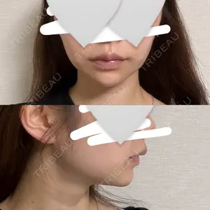 銀座美容外科クリニック 銀座美容外科クリニック 銀座院口コミ