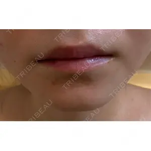 PRISM Beauty Clinic  PRISM Beauty Clinic 町田院口コミ