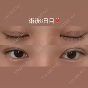 口コミ