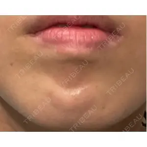 形成外科と美容外科のクリニック池袋口コミ