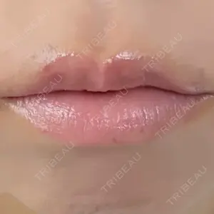口コミ