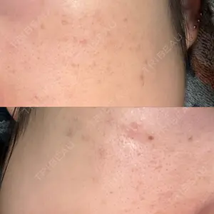 NEO Skin Clinic NEO Skin Clinic恵比寿口コミ