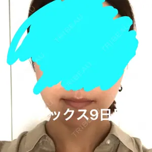 湘南美容クリニック 湘南美容クリニック 新宿本院口コミ
