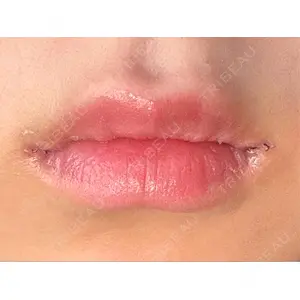 口コミ