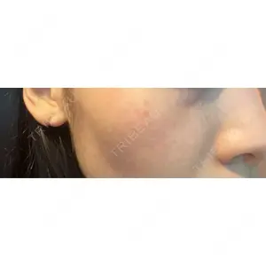 L‘amour clinic Tokyo【ラムールクリニック東京】口コミ