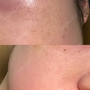 NEO Skin Clinic NEO Skin Clinic恵比寿口コミ