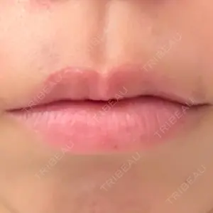 口コミ