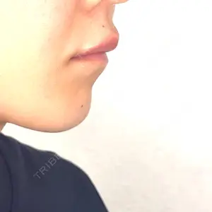 アリエル美容クリニック アリエル美容クリニック 横浜院口コミ