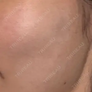 ルラ美容クリニック ルラ美容クリニック 大宮院 / ルラスキンクリニック 大宮院口コミ