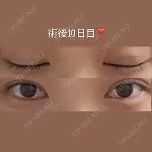 口コミ