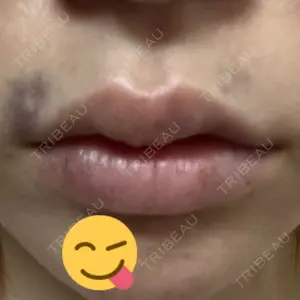 プライベートスキンクリニック 梅田本院口コミ