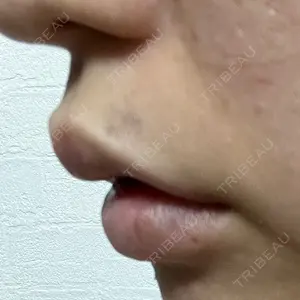 プライベートスキンクリニック 梅田本院口コミ