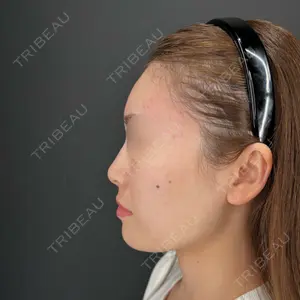 HAAB×DREAM BEAUTY CLINIC HAAB×DREAM BEAUTY CLINIC 大阪梅田院口コミ