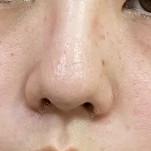 東京素肌クリニックの口コミ