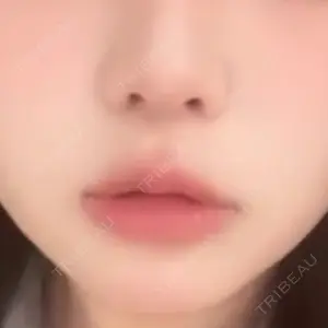 口コミ
