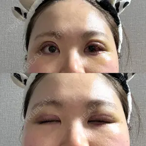 口コミ