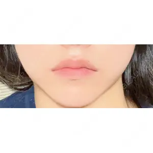 フィラークリニック フィラークリニック 大阪心斎橋院口コミ