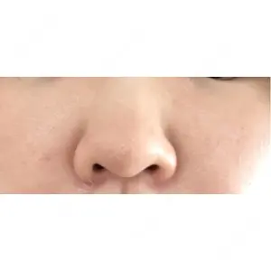 まゆりなclinic 名古屋栄口コミ