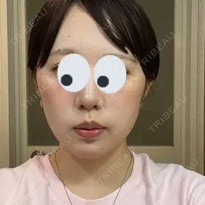 東京素肌クリニックの口コミ