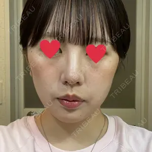 東京素肌クリニックの口コミ