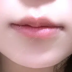 口コミ