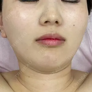 口コミ