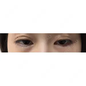 HAAB×DREAM BEAUTY CLINIC HAAB×DREAM BEAUTY CLINIC 東京本院口コミ