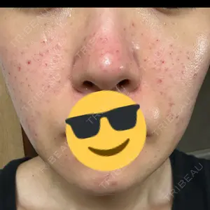 ゆきスキンクリニック 東池袋口コミ