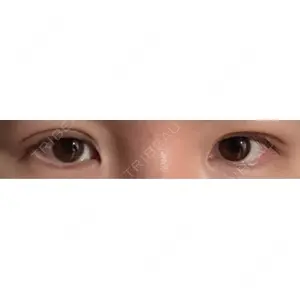 HAAB×DREAM BEAUTY CLINIC HAAB×DREAM BEAUTY CLINIC 東京本院口コミ