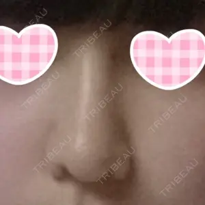 HANABI整形外科口コミ